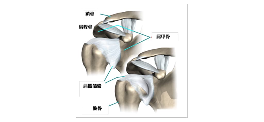 adhesive-capsulitis-frozen-shoulder-info-1